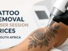 Tattoo Removal Laser Session Prices in South Africa